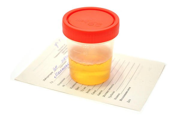 urina campione