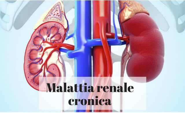 Malattia renale cronica: sintomi, diagnosi e cure